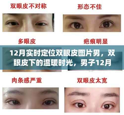 男子双眼皮恢复之旅,冬季温暖时光与友情的碰撞