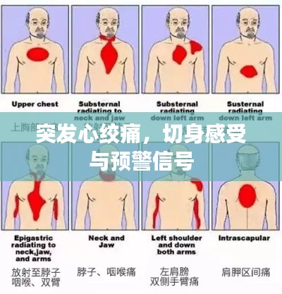 突发心绞痛,切身感受与预警信号